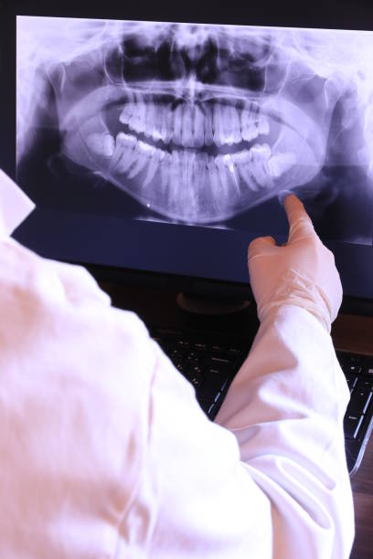 Best Emergency Care for Gum Disease in Brookhaven, MS